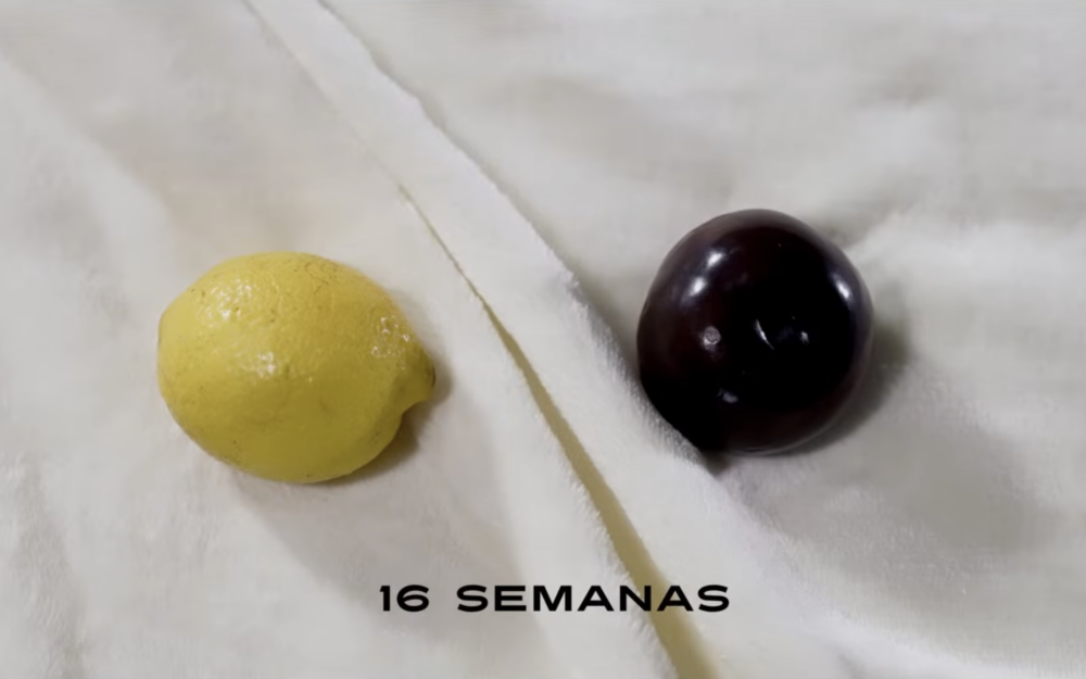 Racismo